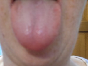 Your tongue is a critical part of your mouth