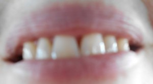 Teeth