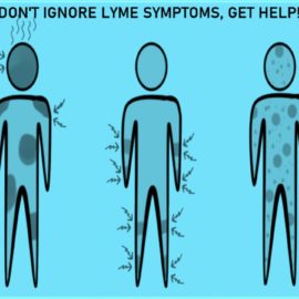 Don’t Ignore Lyme Symptoms